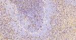Galectin 1 Antibody in Immunohistochemistry (Paraffin) (IHC (P))