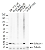 Galectin 1 Antibody in Western Blot (WB)