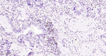 CD134 Antibody in Immunohistochemistry (Paraffin) (IHC (P))