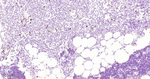 CD134 Antibody in Immunohistochemistry (Paraffin) (IHC (P))