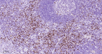CD134 Antibody in Immunohistochemistry (Paraffin) (IHC (P))