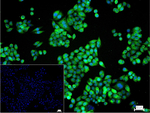 Stathmin 1 Recombinant Rabbit Monoclonal Antibody (S9H7)