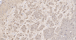 Stathmin 1 Antibody in Immunohistochemistry (Paraffin) (IHC (P))