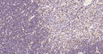 Stathmin 1 Antibody in Immunohistochemistry (Paraffin) (IHC (P))