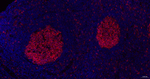 Stathmin 1 Antibody in Immunohistochemistry (Paraffin) (IHC (P))