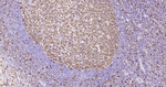 Stathmin 1 Antibody in Immunohistochemistry (Paraffin) (IHC (P))