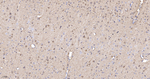 Stathmin 1 Antibody in Immunohistochemistry (Paraffin) (IHC (P))