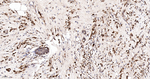 Stathmin 1 Antibody in Immunohistochemistry (Paraffin) (IHC (P))