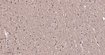 Stathmin 1 Antibody in Immunohistochemistry (Paraffin) (IHC (P))