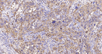 Stathmin 1 Antibody in Immunohistochemistry (Paraffin) (IHC (P))