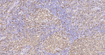 Stathmin 1 Antibody in Immunohistochemistry (Paraffin) (IHC (P))