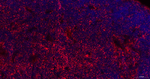 Stathmin 1 Antibody in Immunohistochemistry (Paraffin) (IHC (P))