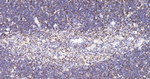 Stathmin 1 Antibody in Immunohistochemistry (Paraffin) (IHC (P))