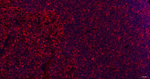 Stathmin 1 Antibody in Immunohistochemistry (Paraffin) (IHC (P))