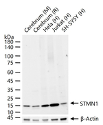Stathmin 1 Antibody in Western Blot (WB)