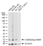 p16INK4a Antibody in Western Blot (WB)