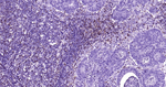 CD2 Antibody in Immunohistochemistry (Paraffin) (IHC (P))