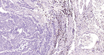 CD2 Antibody in Immunohistochemistry (Paraffin) (IHC (P))