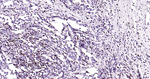 CD2 Antibody in Immunohistochemistry (Paraffin) (IHC (P))