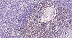 CD2 Antibody in Immunohistochemistry (Paraffin) (IHC (P))