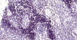 CD2 Antibody in Immunohistochemistry (Paraffin) (IHC (P))