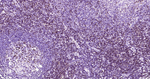CD2 Antibody in Immunohistochemistry (Paraffin) (IHC (P))