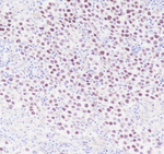 SALL4 Recombinant Rabbit Monoclonal Antibody (A5C1)
