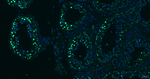 SALL4 Antibody in Immunohistochemistry (Paraffin) (IHC (P))