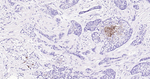 ALDH1A1 Antibody in Immunohistochemistry (Paraffin) (IHC (P))