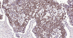 ALDH1A1 Antibody in Immunohistochemistry (Paraffin) (IHC (P))