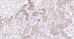 ALDH1A1 Antibody in Immunohistochemistry (Paraffin) (IHC (P))