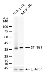 STING Antibody in Western Blot (WB)
