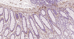 Caldesmon Antibody in Immunohistochemistry (Paraffin) (IHC (P))