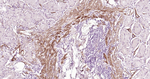 Caldesmon Antibody in Immunohistochemistry (Paraffin) (IHC (P))