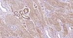 Caldesmon Antibody in Immunohistochemistry (Paraffin) (IHC (P))