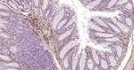 Caldesmon Antibody in Immunohistochemistry (Paraffin) (IHC (P))