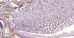 Caldesmon Antibody in Immunohistochemistry (Paraffin) (IHC (P))