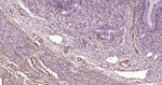 Caldesmon Antibody in Immunohistochemistry (Paraffin) (IHC (P))