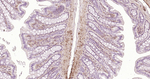 Caldesmon Antibody in Immunohistochemistry (Paraffin) (IHC (P))