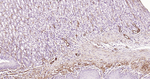 Caldesmon Antibody in Immunohistochemistry (Paraffin) (IHC (P))