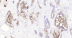 CD66a Recombinant Rabbit Monoclonal Antibody (A10D5)