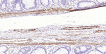 Pan Actin Antibody in Immunohistochemistry (Paraffin) (IHC (P))