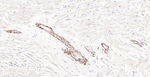 Pan Actin Antibody in Immunohistochemistry (Paraffin) (IHC (P))