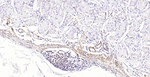 Pan Actin Antibody in Immunohistochemistry (Paraffin) (IHC (P))