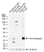 SCGN Antibody in Western Blot (WB)