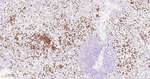 S100P Antibody in Immunohistochemistry (Paraffin) (IHC (P))