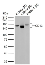 CD13 Antibody in Western Blot (WB)