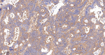 HIP Antibody in Immunohistochemistry (Paraffin) (IHC (P))