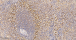 HIP Antibody in Immunohistochemistry (Paraffin) (IHC (P))