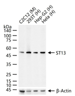 HIP Antibody in Western Blot (WB)
